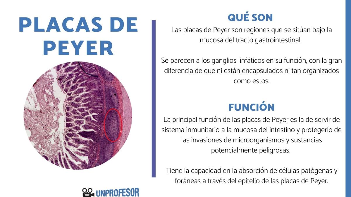 Qué son las placas de Peyer y su función