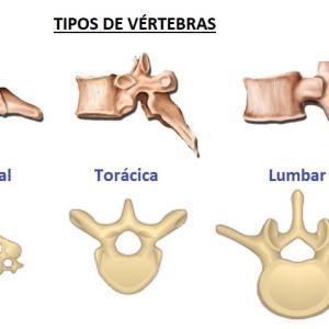 Los tipos de vértebras