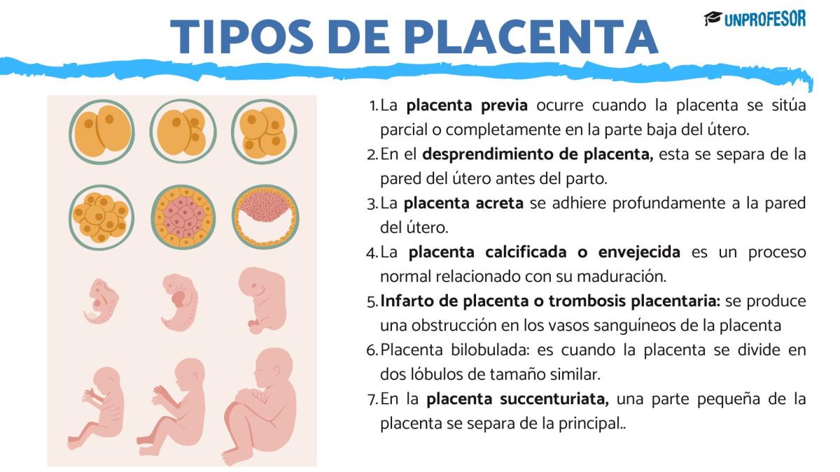 Tipos de placenta