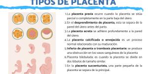 Tipos de placenta