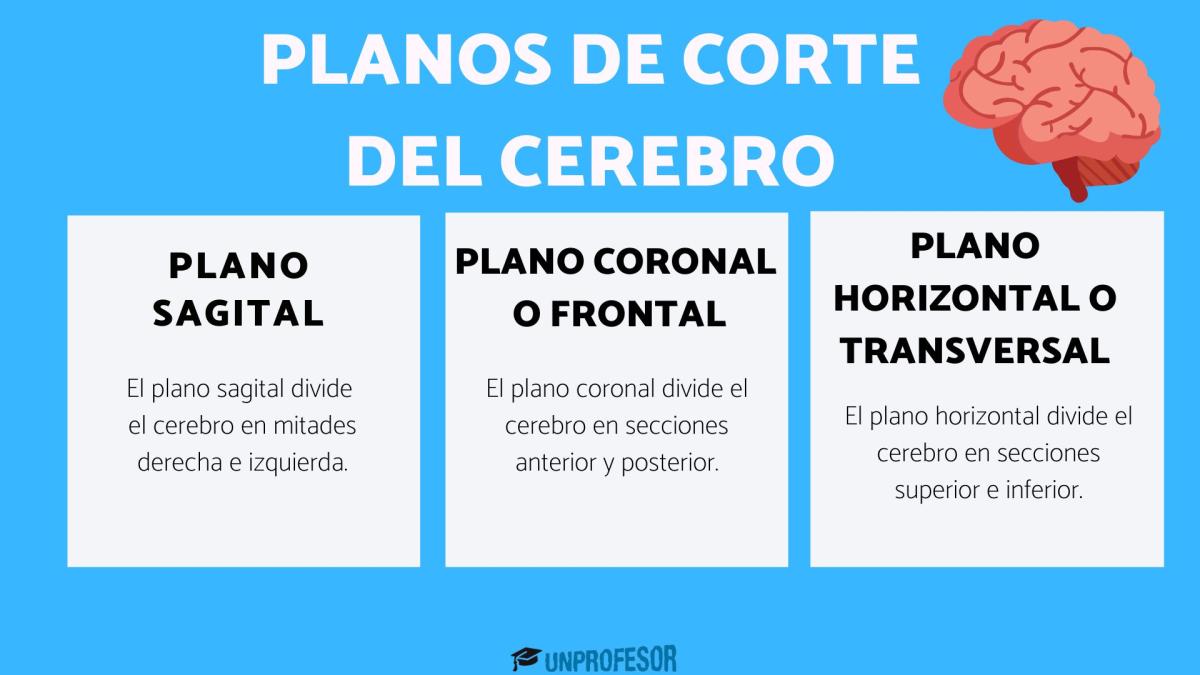 Planos de corte del cerebro